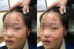 Nữ sinh Hà Nội đánh em lớp dưới chảy máu mặt bị buộc thôi học 6 ngày-2