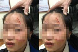 Vụ nữ sinh Hà Nội bị đánh chảy máu mặt: UBND quận yêu cầu làm rõ