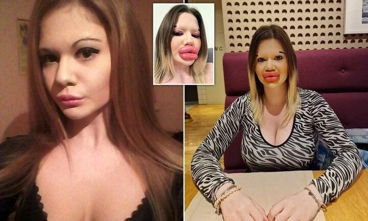 Cô gái có đôi môi lớn nhất thế giới muốn bán đấu giá những nụ hôn-4