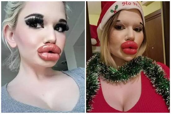 Cô gái có đôi môi lớn nhất thế giới muốn bán đấu giá những nụ hôn