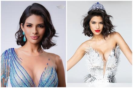 Nhan sắc gây tranh cãi của Hoa hậu đẹp nhất thế giới 2023