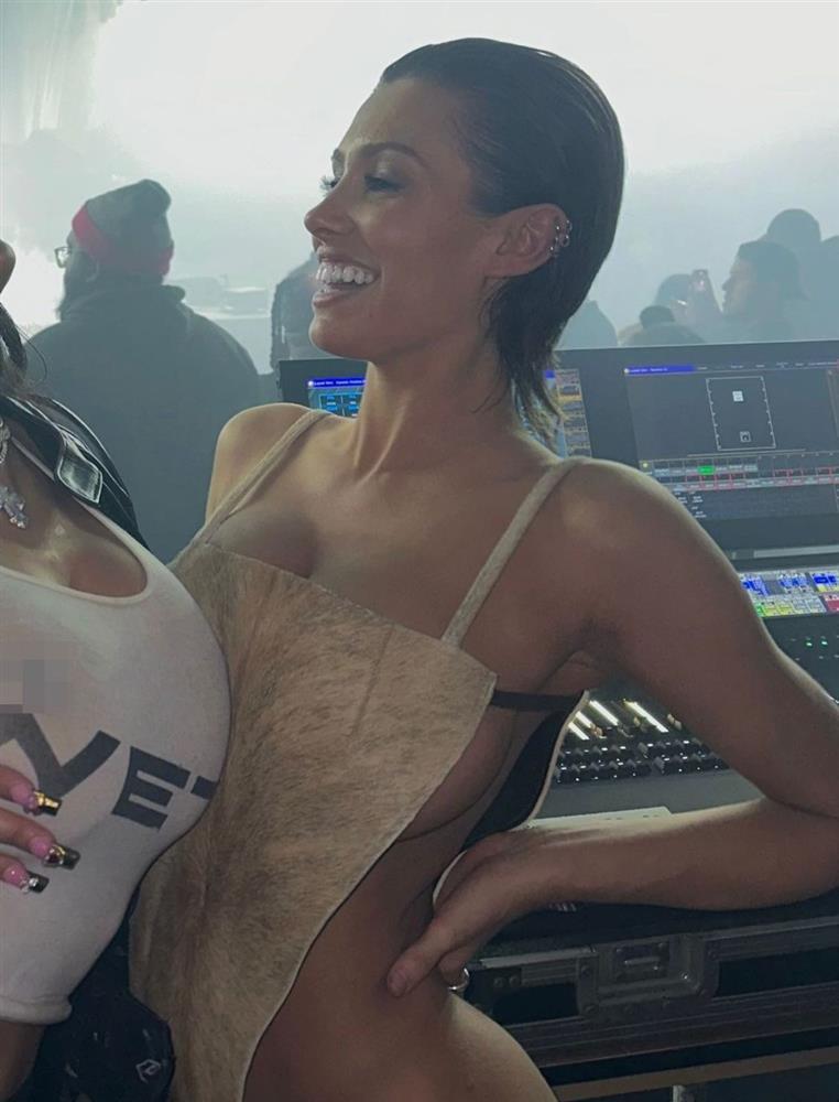 Gương mặt biến dạng của Kanye West sau khi nhổ hết răng-3