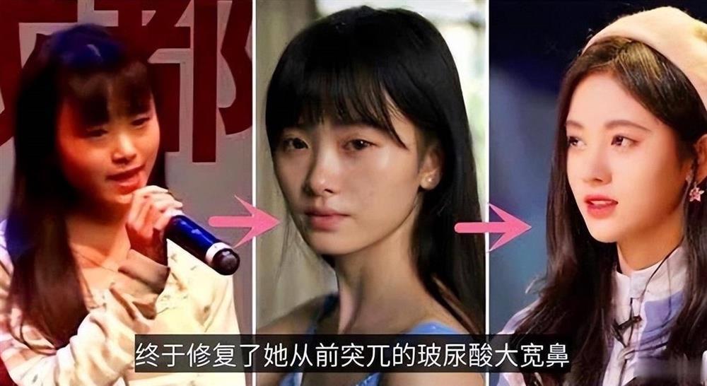 Nữ diễn viên lên đời nhờ chỉnh sửa nhan sắc thành công-1