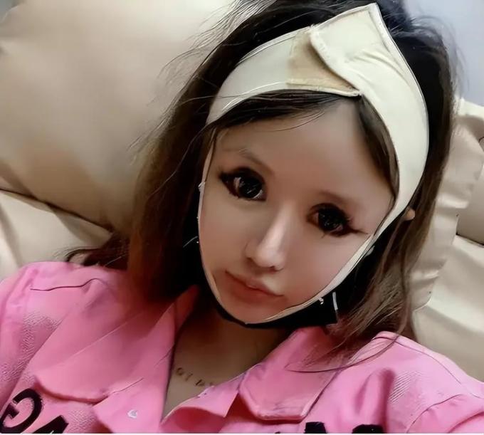 Phẫu thuật quá độ, cô gái nghiện làm đẹp từ năm 13 tuổi vô cùng hối hận vì quyết định bản thân-3