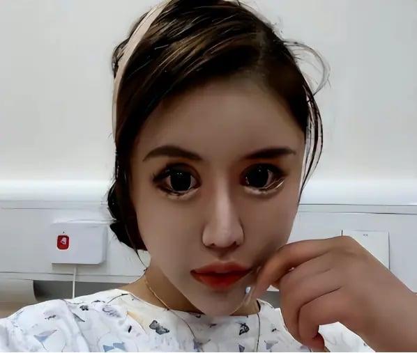 Phẫu thuật quá độ, cô gái nghiện làm đẹp từ năm 13 tuổi vô cùng hối hận vì quyết định bản thân-4