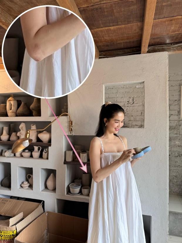 Ngọc Trinh ngậm ngùi chia sẻ tình trạng những vết thương sau 4 tháng gặp tai nạn lái xe mô tô-3