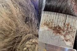 Cô gái khiến dân mạng rùng mình vì clip xử lý những mái tóc lúc nhúc chấy rận