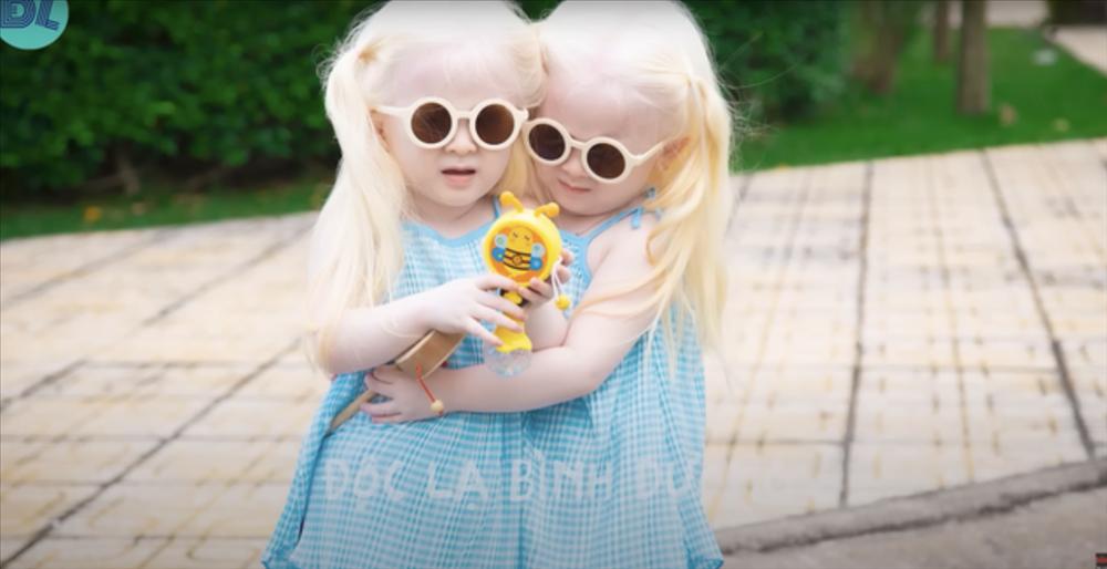 Đẻ cặp song sinh kỳ lạ, vợ chồng Sóc Trăng tuyệt vọng, nhiều năm sau bỗng nổi tiếng khắp vùng: Da trắng, mắt xanh và vô cùng lễ phép, ai gặp cũng yêu mến-1