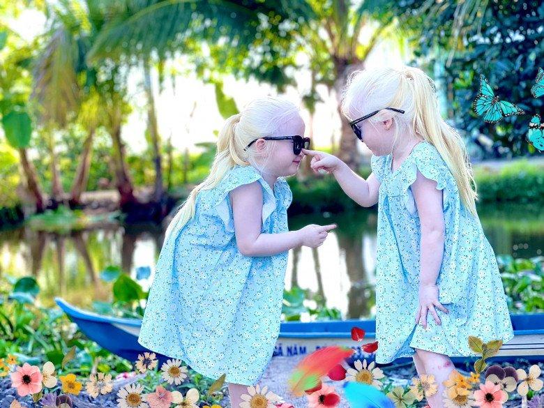 Đẻ cặp song sinh kỳ lạ, vợ chồng Sóc Trăng tuyệt vọng, nhiều năm sau bỗng nổi tiếng khắp vùng: Da trắng, mắt xanh và vô cùng lễ phép, ai gặp cũng yêu mến-3