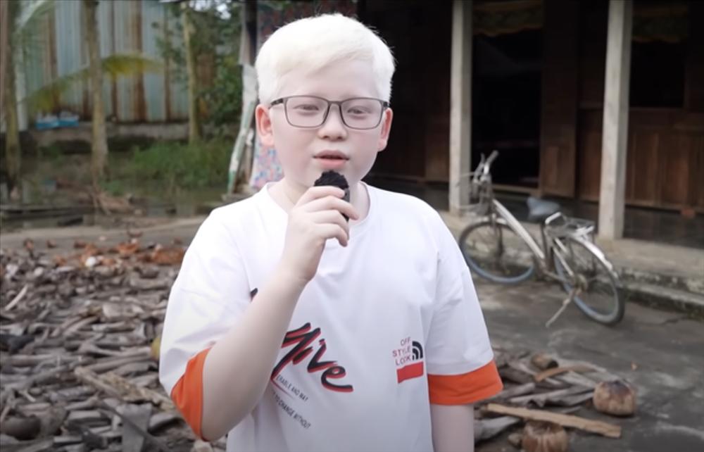 Đẻ cặp song sinh kỳ lạ, vợ chồng Sóc Trăng tuyệt vọng, nhiều năm sau bỗng nổi tiếng khắp vùng: Da trắng, mắt xanh và vô cùng lễ phép, ai gặp cũng yêu mến-4