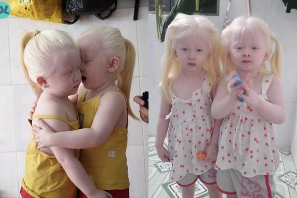 Cặp song sinh Nhật Bản được mệnh danh đẹp tới mức triệu năm có một-7