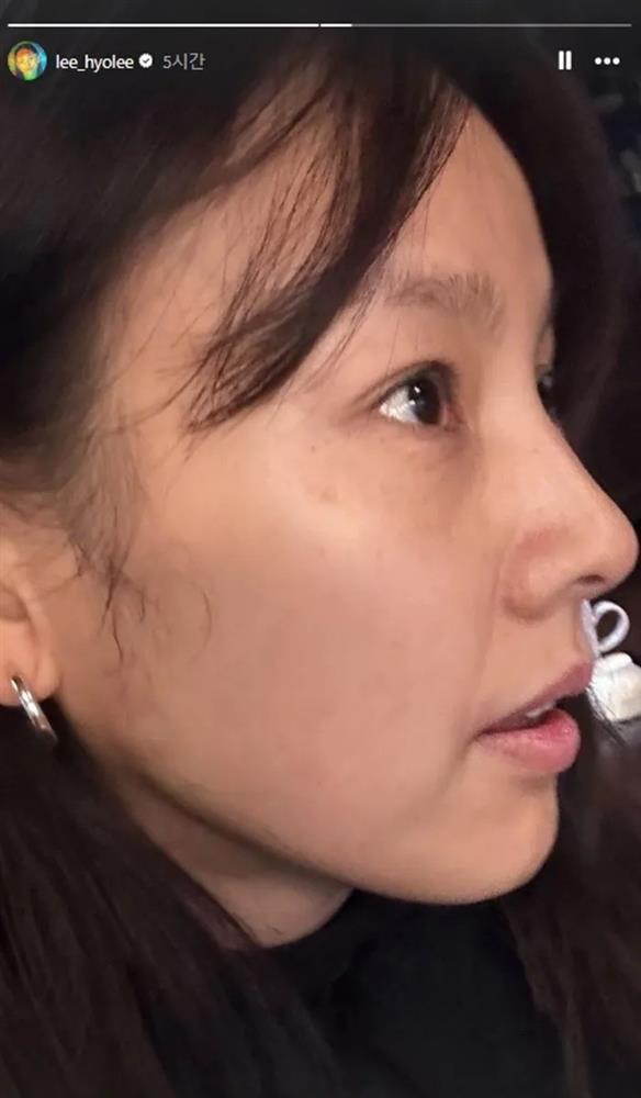 Nữ hoàng gợi cảm xứ Hàn tự bóc nhan sắc ở tuổi U45-2