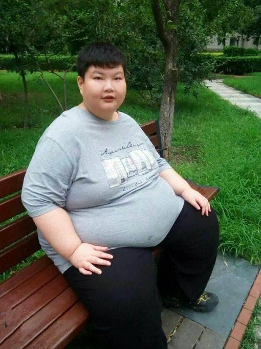 Cậu bé 14 tuổi nặng 180kg khóc xin bác sĩ giúp giảm cân giờ ra sao?-1