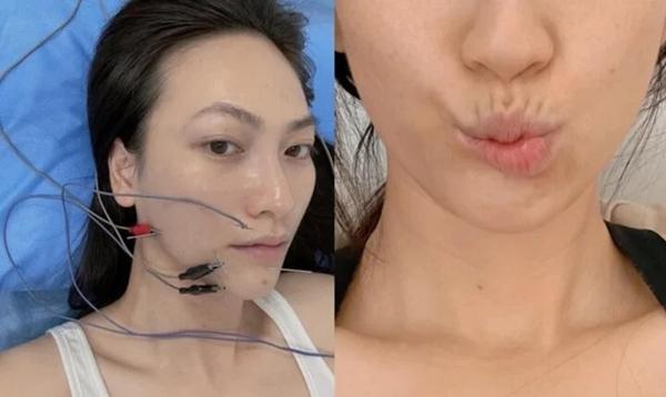 Nữ chính phim ‘Mai’ từng muốn bỏ nghề vì méo khung môi sau khi mắc bệnh nặng-2