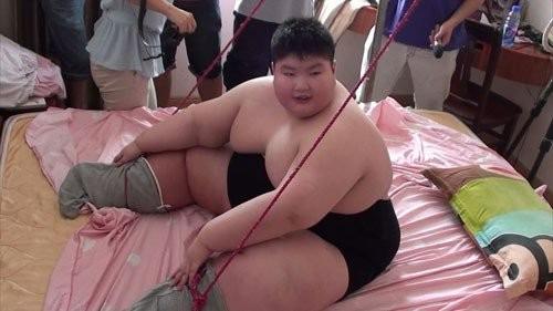 Cậu bé 14 tuổi nặng 180kg khóc xin bác sĩ giúp giảm cân giờ ra sao?-5