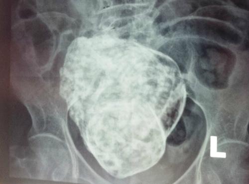 Cụ bà 91 tuổi đi viện, bác sĩ bất ngờ thông báo có thai, tiết lộ bí mật giấu kín suốt 60 năm-2