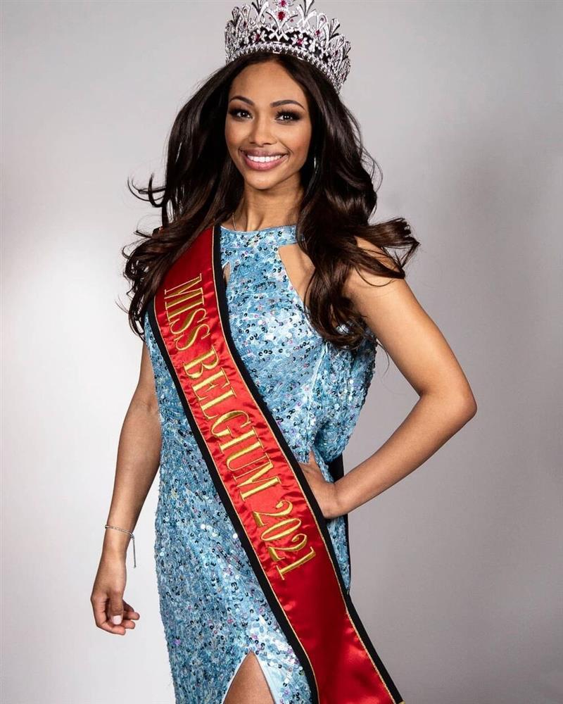 Hoa hậu thế giới Bỉ bị cha bỏ ở trại mồ côi năm 9 tuổi, mẹ kế bạo hành-7