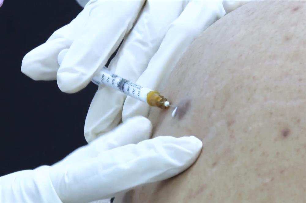 Lên mạng tìm tình 1 đêm để hết cô đơn, chàng trai 20 tuổi mắc bệnh lậu-3