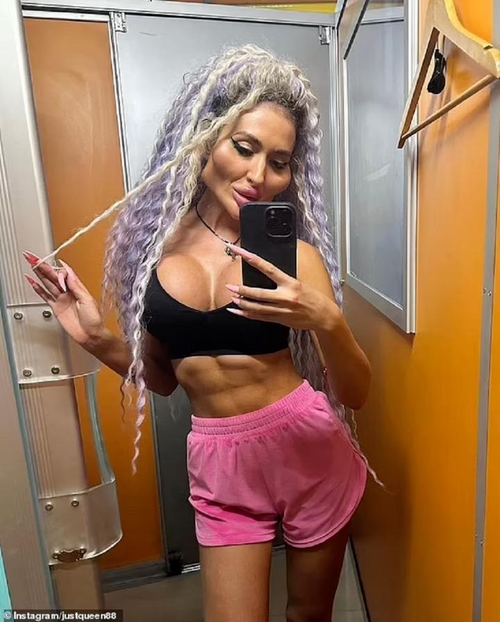 Nhan sắc kỳ lạ của cô gái có gò má to nhất thế giới-1