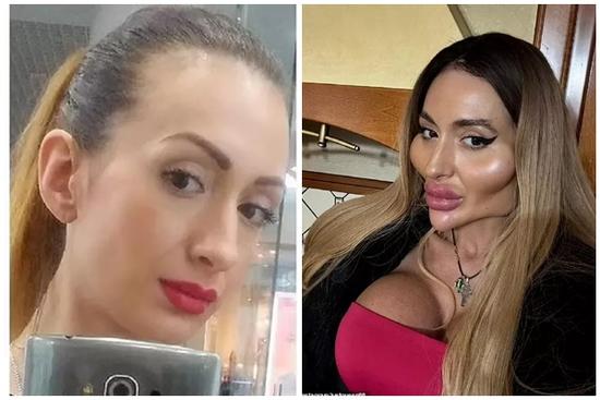 Nhan sắc kỳ lạ của cô gái có gò má to nhất thế giới