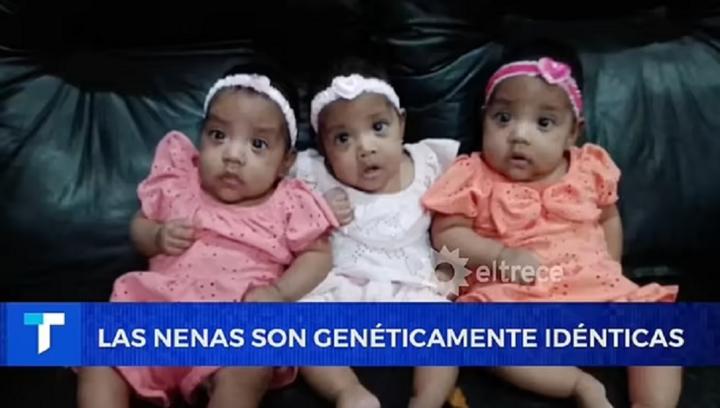 Ca sinh ba siêu hiếm: Mẹ mang thai tự nhiên, sinh 3 bé gái giống hệt nhau-4