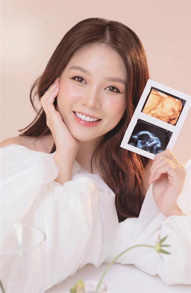 Sam hạ sinh cặp rồng con, nhan sắc hậu vượt cạn vẫn xinh đẹp rạng rỡ-4