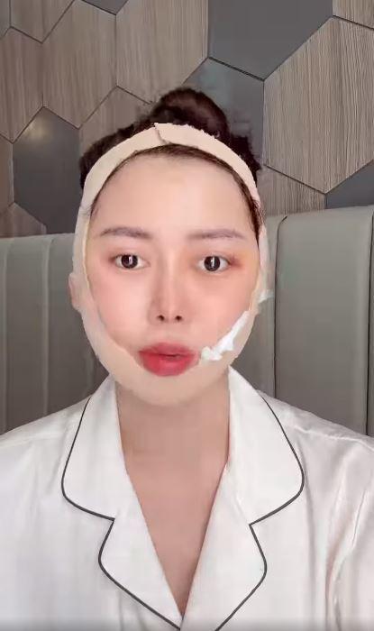 Gương mặt biến dạng của chị Google Việt Phương Thoa gây xôn xao-2