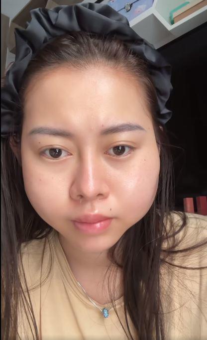 Gương mặt biến dạng của chị Google Việt Phương Thoa gây xôn xao-3