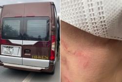 Nữ hành khách bị nhà xe Quảng Ninh bóp cổ, bỏ rơi giữa cao tốc: 'Nhà xe phớt lờ, phụ xe còn quay lại văng tục, chửi bới khách'