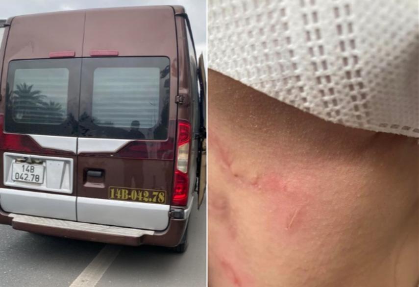 Nữ hành khách bị nhà xe Quảng Ninh bóp cổ, bỏ rơi giữa cao tốc: Nhà xe phớt lờ, phụ xe còn quay lại văng tục, chửi bới khách-1