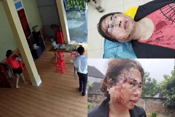 Lấy lời khai vụ bị chồng kém 11 tuổi đánh gãy xương sườn trước ngày ly hôn-3