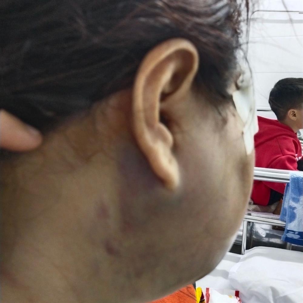 Lấy lời khai vụ bị chồng kém 11 tuổi đánh gãy xương sườn trước ngày ly hôn-1