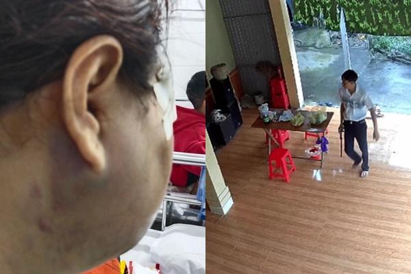 Người phụ nữ bị chồng bạo hành trước ngày ly hôn: Chồng tôi mắc bệnh cuồng ghen-3