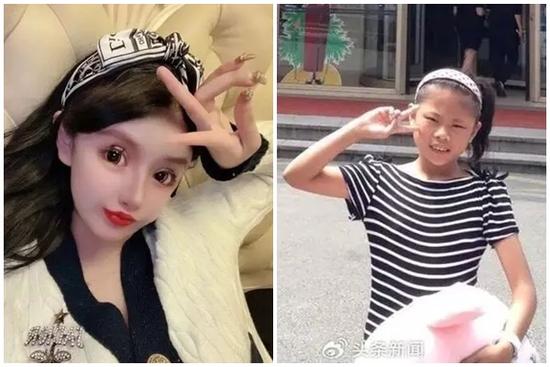 Mới 18 tuổi, cô gái đã 100 lần phẫu thuật thẩm mỹ, tốn gần 14 tỷ đồng