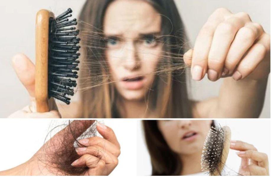 Cách giúp hạn chế tóc gãy rụng cho chị em 30+-1