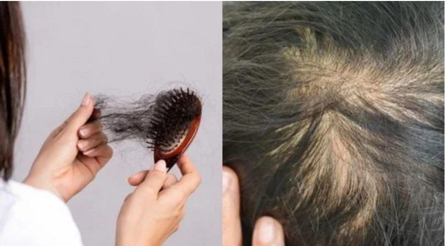 Cách giúp hạn chế tóc gãy rụng cho chị em 30+-2