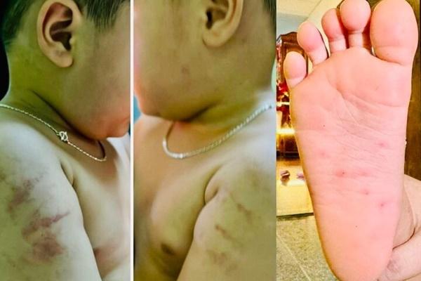 Đình chỉ đứng lớp đối với nữ giáo viên đánh vào mặt và đầu trẻ mầm non-2