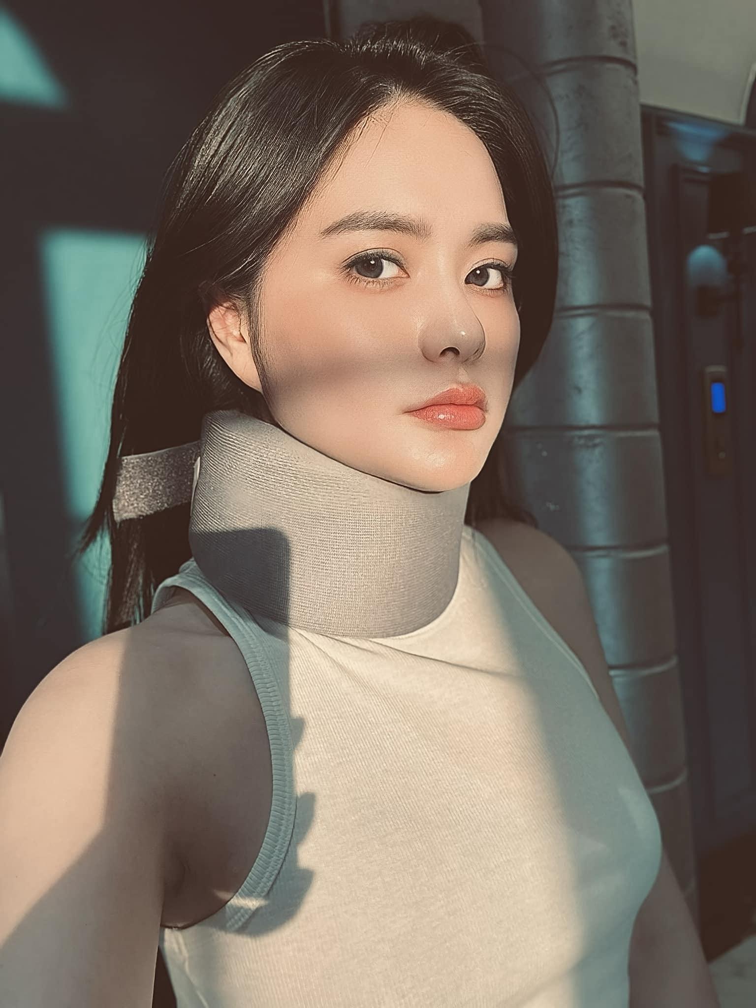 Đoàn Di Băng nẹp cổ, biến dạng đốt sống: Tình trạng cụ thể ra sao?-5