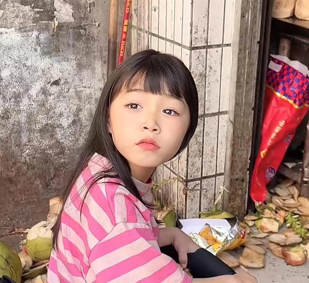 Bé gái xinh đẹp hút 2,4 triệu lượt theo dõi, gây bất ngờ khi mắc bệnh lạ-7