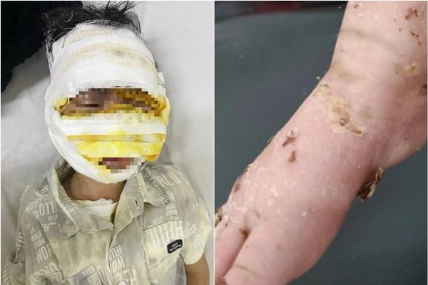 Nữ sinh lớp 9 bị nhóm bạn cùng trường đánh đập dã man-2