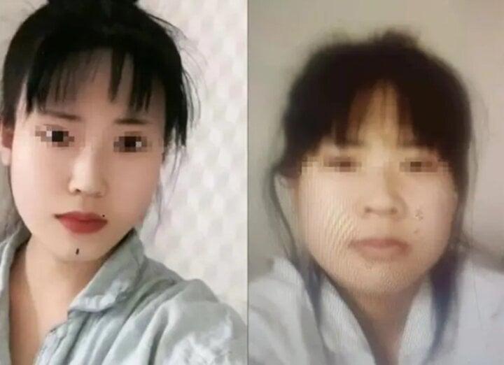 Thất vọng với kết quả phẫu thuật thẩm mỹ, cô gái nhảy sông ngay khi xuất viện-1