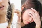 Chuyên gia chỉ ra 5 lý do khiến tóc gãy rụng đến mức 'ám ảnh'