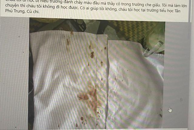 TP HCM: Xác minh sự việc hiệu trưởng đánh học sinh chảy máu-1
