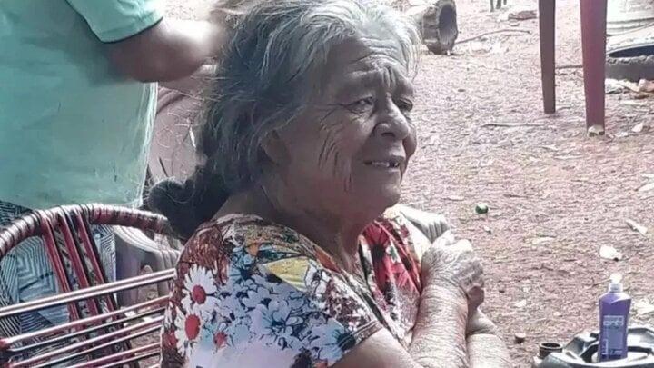 Cụ bà 81 tuổi chết sau khi loại bỏ bào thai bị vôi hóa trong cơ thể suốt 56 năm-1