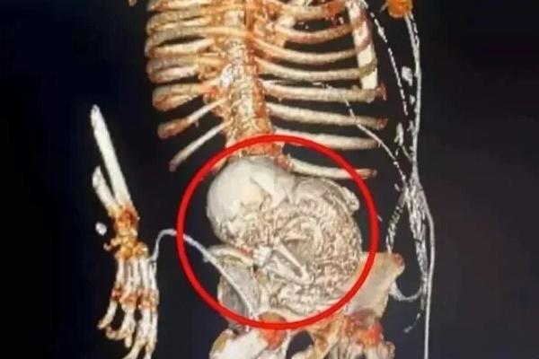 Từng mắc ung thư, cụ bà U80 vẫn khỏe mạnh, thi đấu ba môn phối hợp: Bí quyết nằm ở 5 điều-3