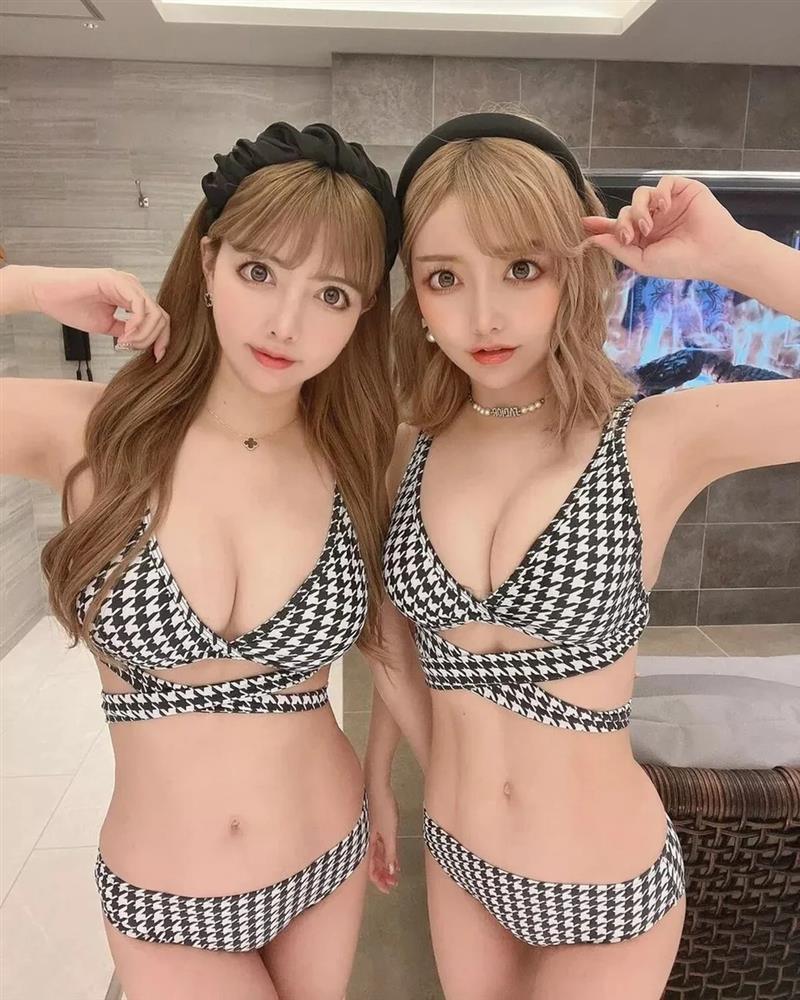 Cặp sinh đôi Nhật Bản gây sốt vì dao kéo toàn bộ gương mặt giờ ra sao?-2