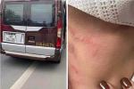 Phụ xe khách bị đánh túi bụi dọc đường-2
