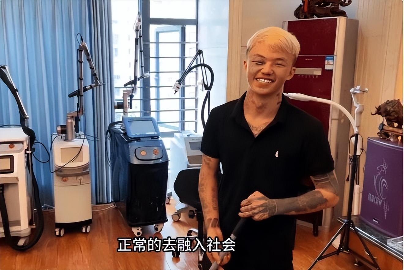 Cuộc đời tủi nhục của cậu bé bỏ nhà đi vì bị bố và mẹ kế đánh đập tàn nhẫn-4