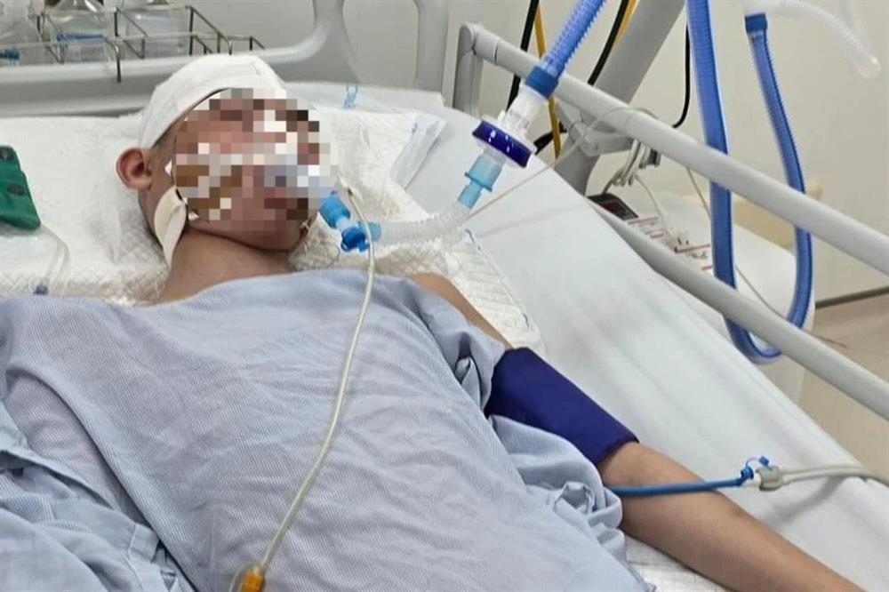 Nam sinh lớp 8 ở Hà Nội bị đánh chấn thương sọ não khi chơi bóng rổ-1