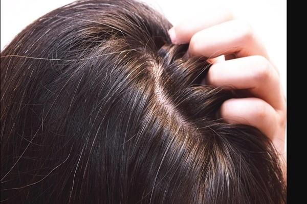 Tóc bạc, bạn nhất định phải biết cách phục hồi đơn giản này-1